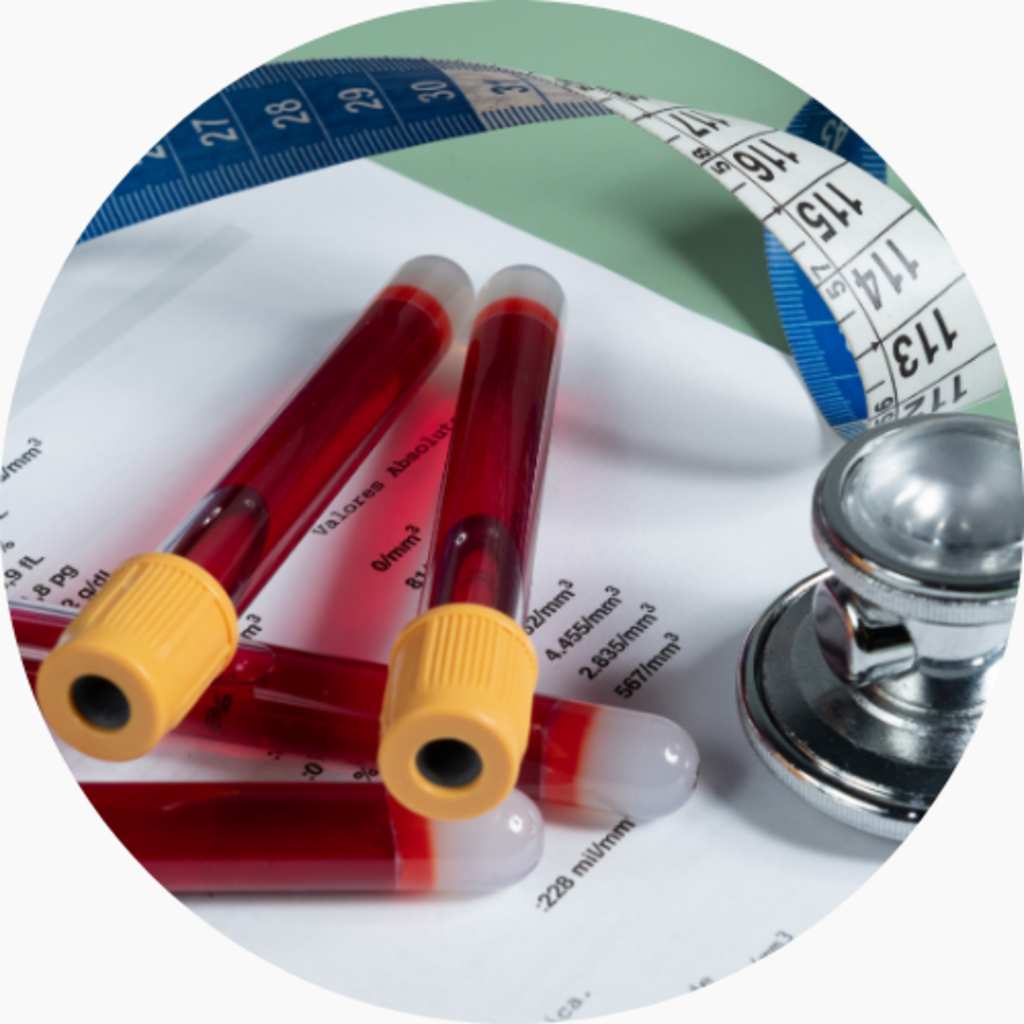 What Is Metabolic Syndrome?