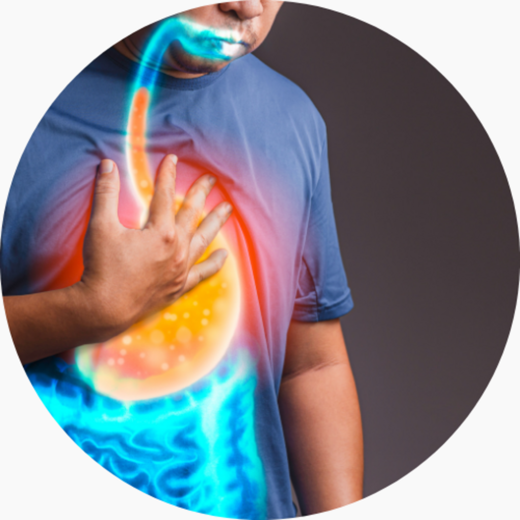 Can Carbohydrates Worsen GERD? How Cutting Carbs Can Improve Acid Reflux