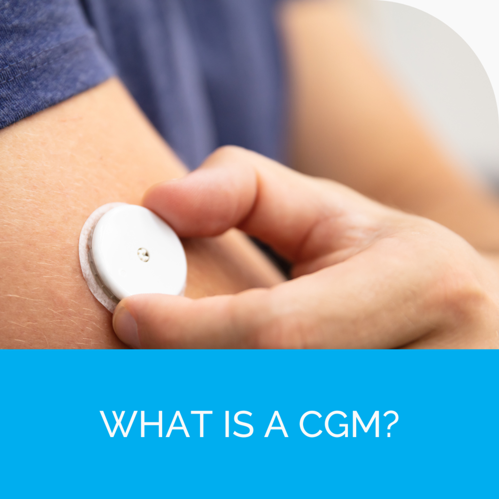 What Is a CGM?