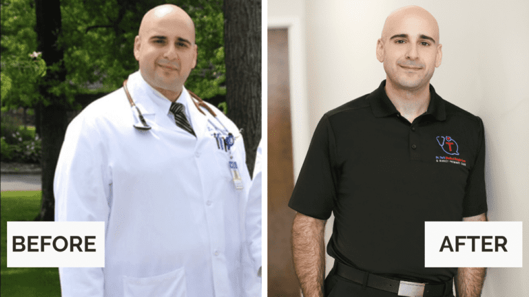Brian Wiley before-and-after photos