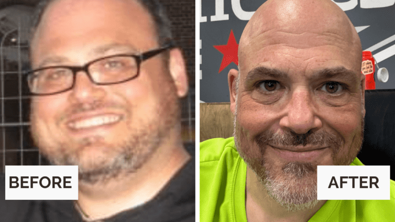 Toward Health member before-and-after photos