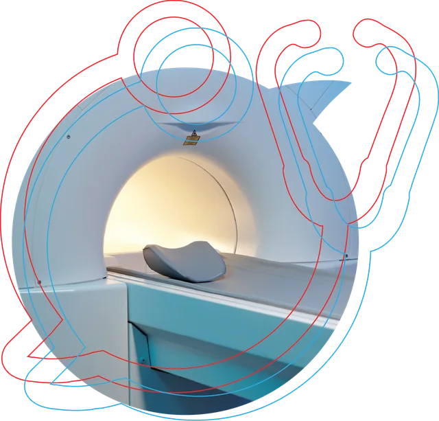 Coronary artery calcium scan image used in Toward Health Heart Scan screening