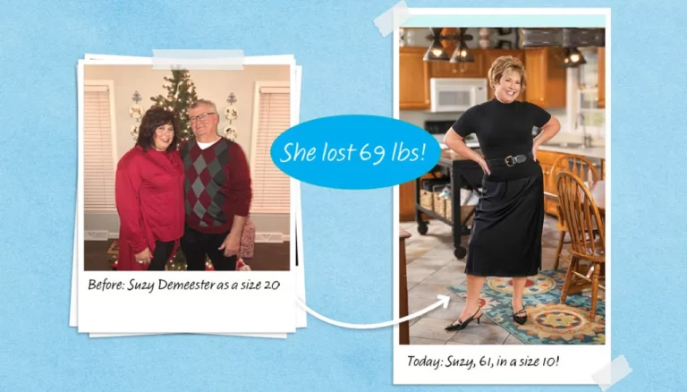 Suzy Demeester before-and-after photos