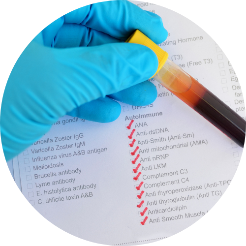 Gloved hand using a yellow pipette to transfer a blood sample onto a medical checklist with red checkmarks on the page