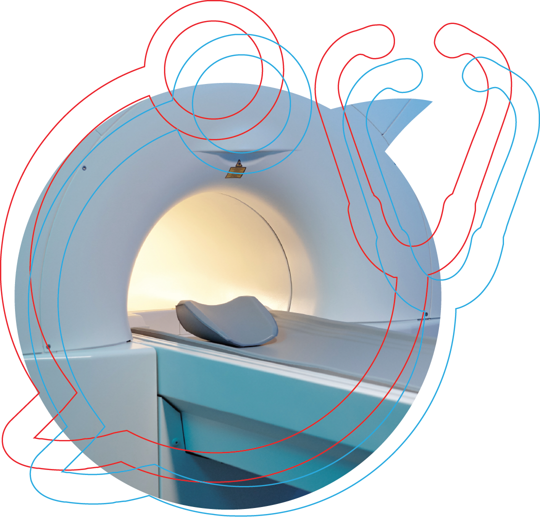 Coronary artery calcium scan image used in Toward Health Heart Scan screening